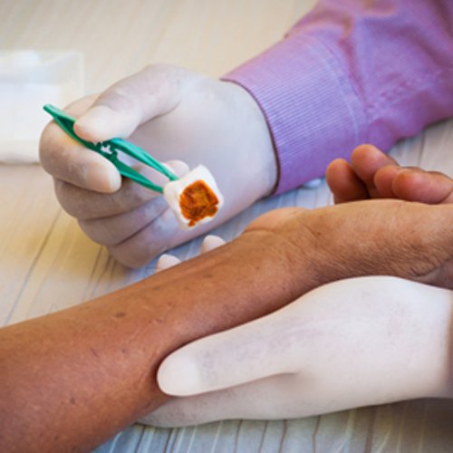 Cura y Sutura de Heridas Menores